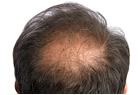 Treatment and application